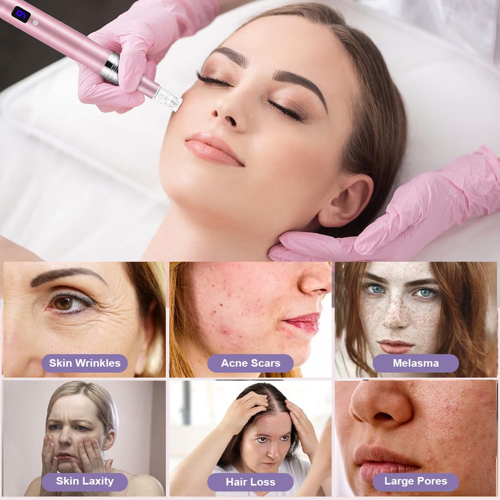 Vicloon Elektrischer Microneedling Pen – LCD-Display, 5 Stufen, Pink