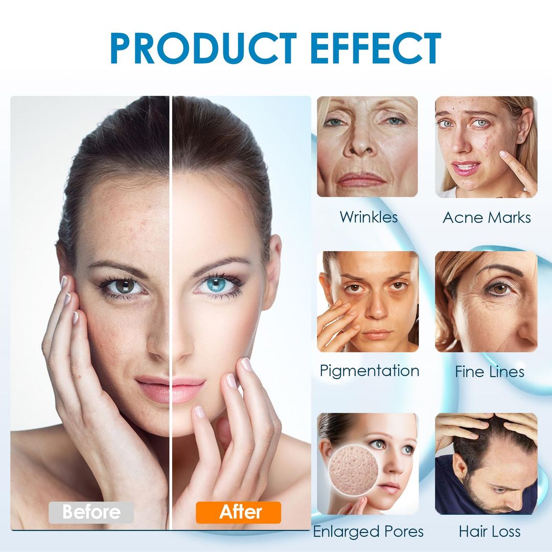 Microneedling-Gerät Kabellos – Touchscreen, 0–2,5 mm Verstellbar, Profi-Mikronadelstift